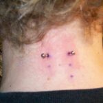Piercing mobil Ruhrpott Nape 1